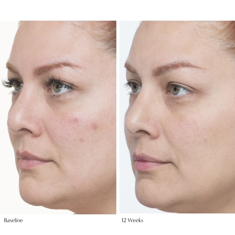 LE PRUNIER Plumscreen® Broad Spectrum SPF 31 UVA/UVB/HEV PA+++